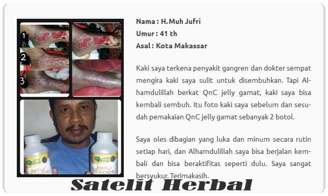 testimoni luka diabetes1-min
